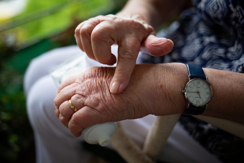 person with rheumatoid arthritis pressing hand